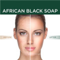 100% Organic Raw African Black Soap for Detoxifying & Anti-Aging